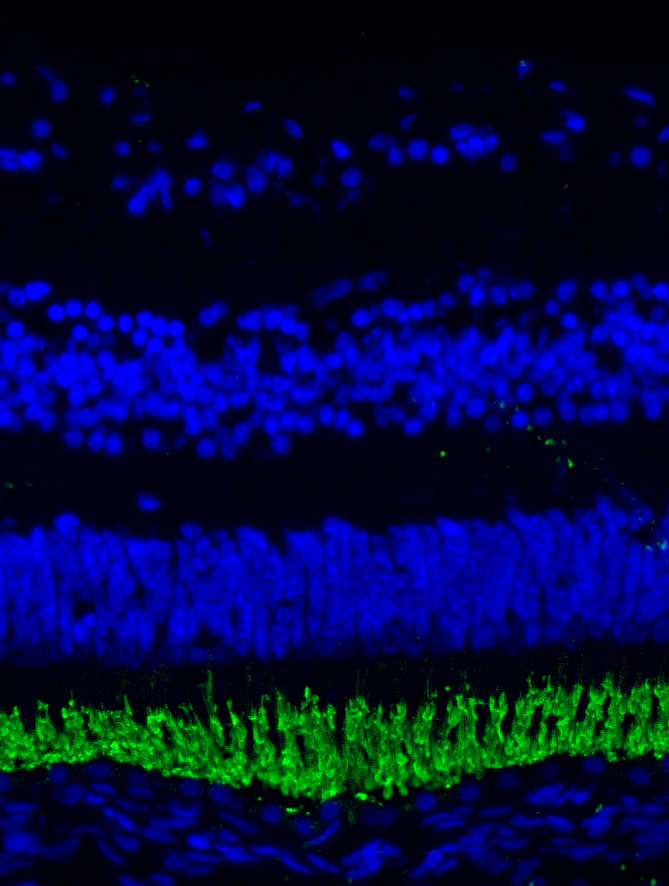 Fluorescence microscopy of the newborn macula shows the presence of rod photoreceptor cells (labeled in green) and three layers of cell nuclear (labeled in blue). Studying the formation of the fovea in these eyes is providing insight into macular diseases.