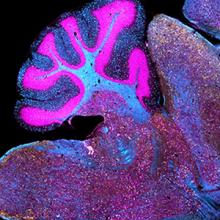 Neurodegenerative disease in mouse
