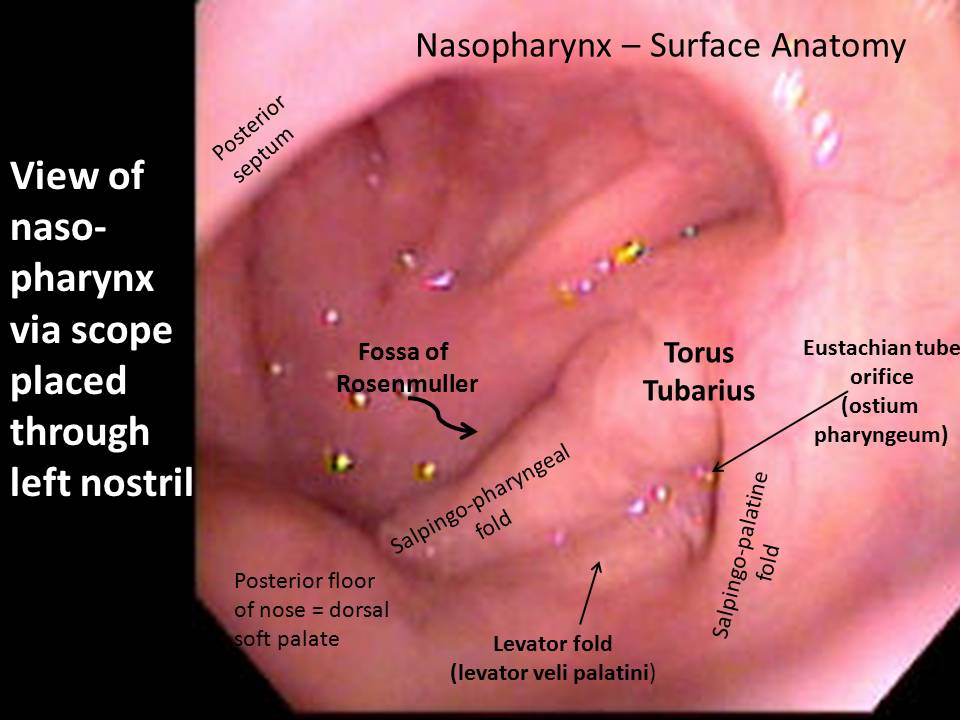 Laryngeal anatomy with relevant landmarks as seen through a laryngoscope.