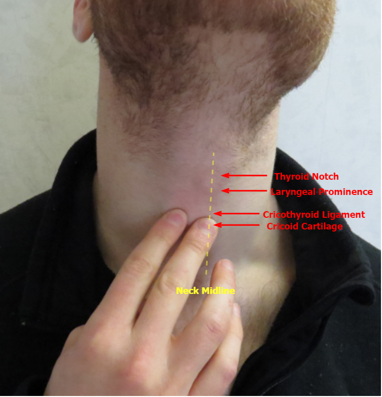 cancerous cyst on neck