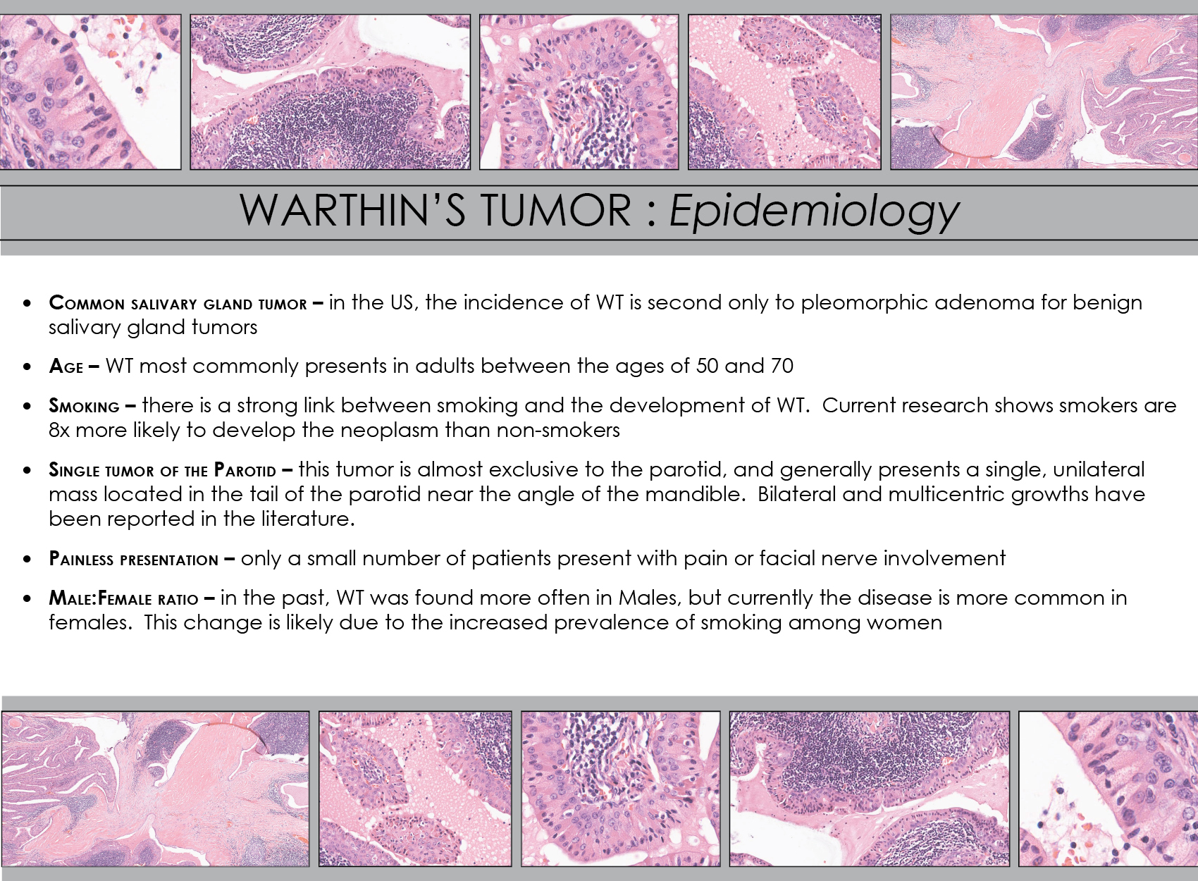 Tumor De Warthin