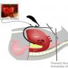 Arshava retractor_ design of a video transhiatal retractor to facilitate mediastinal dissection during transhiatal esophagectomy