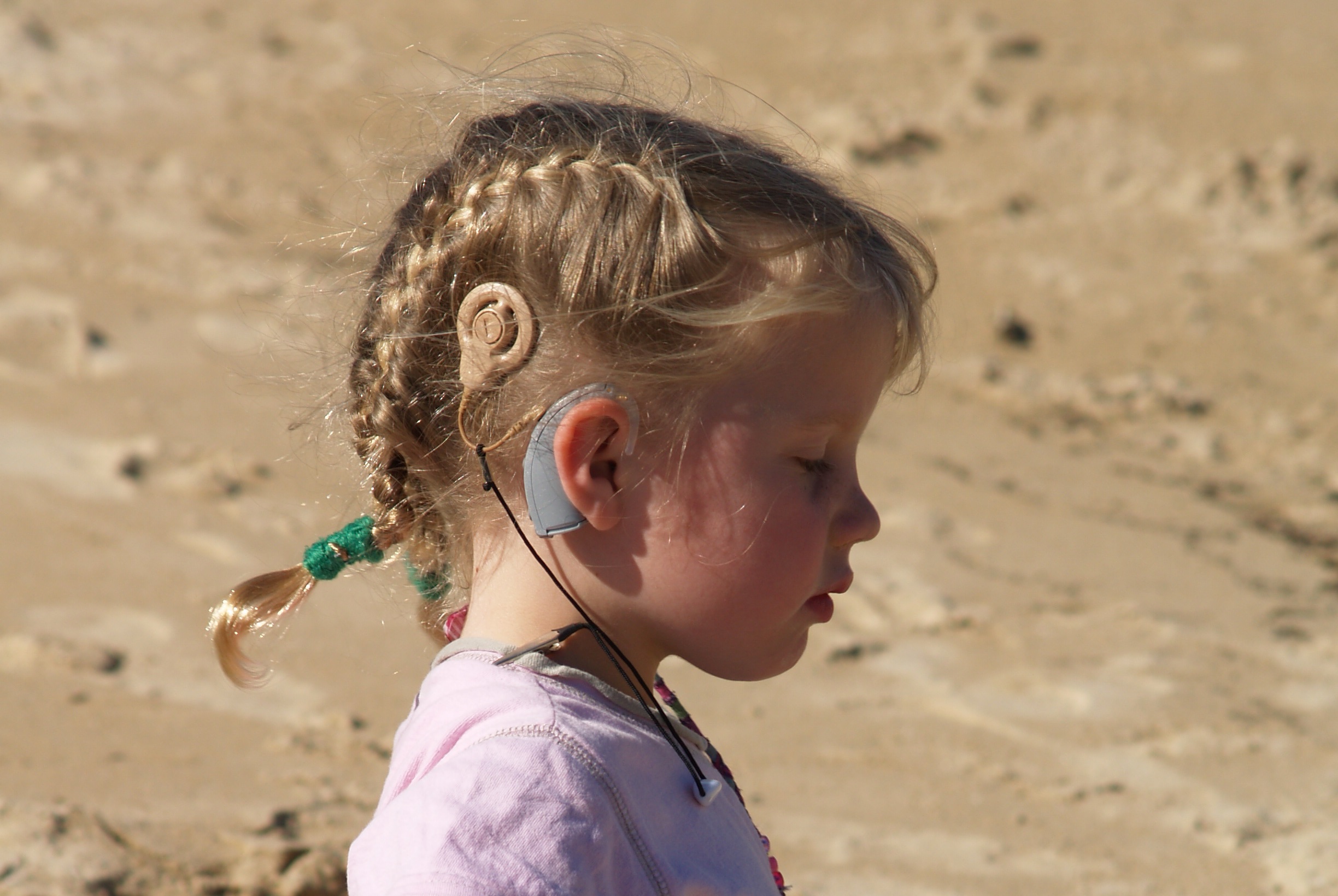 A Girl With a Cochlear Implant