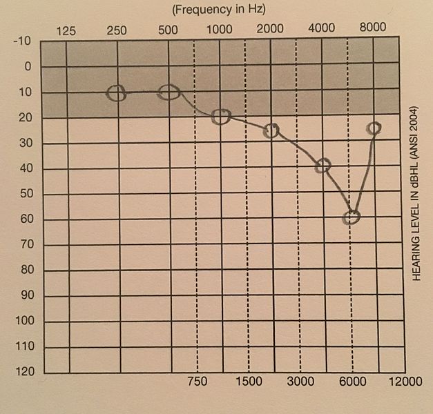Hearing Test Results Chart
