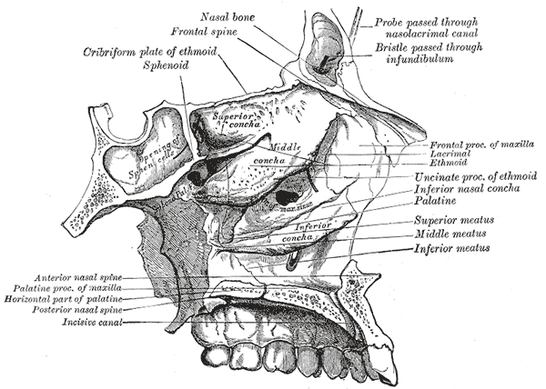 Nosebleed - Epistaxis: Sphenopalatine Artery (SPA) Ligation - Endoscopic