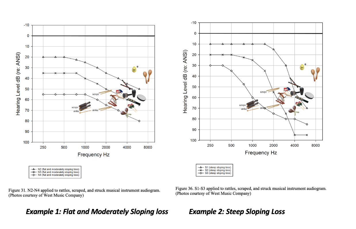 Hearing loss charts