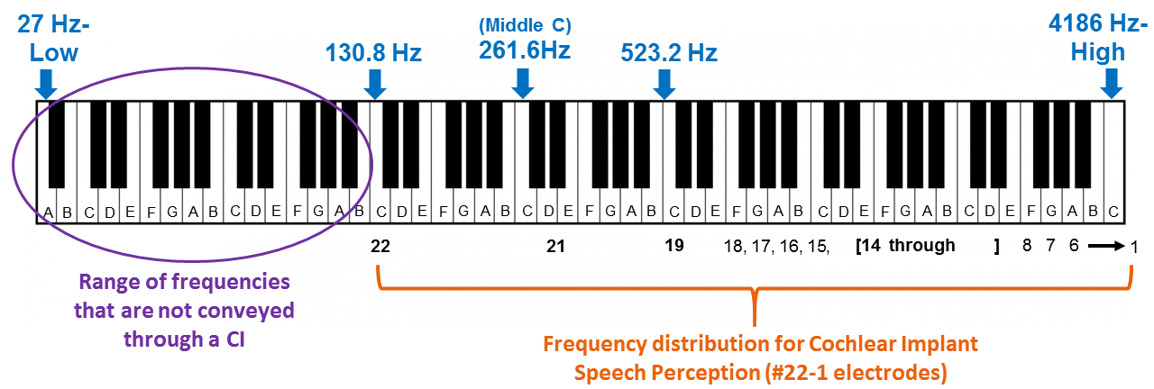 Low Frequency with a Cochlear Implant