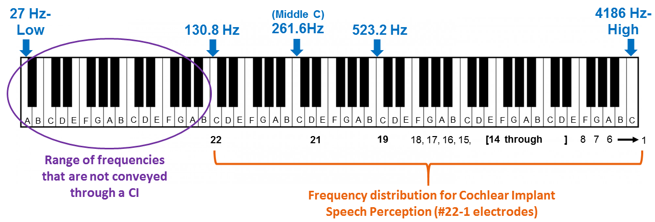 Low frequency with cochlear implant