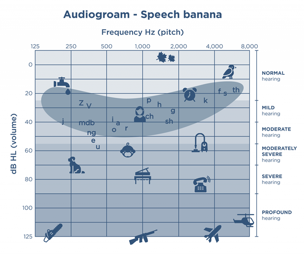 audiogram with icons depicting sound sources and the banana shaped area where speech sounds are located
