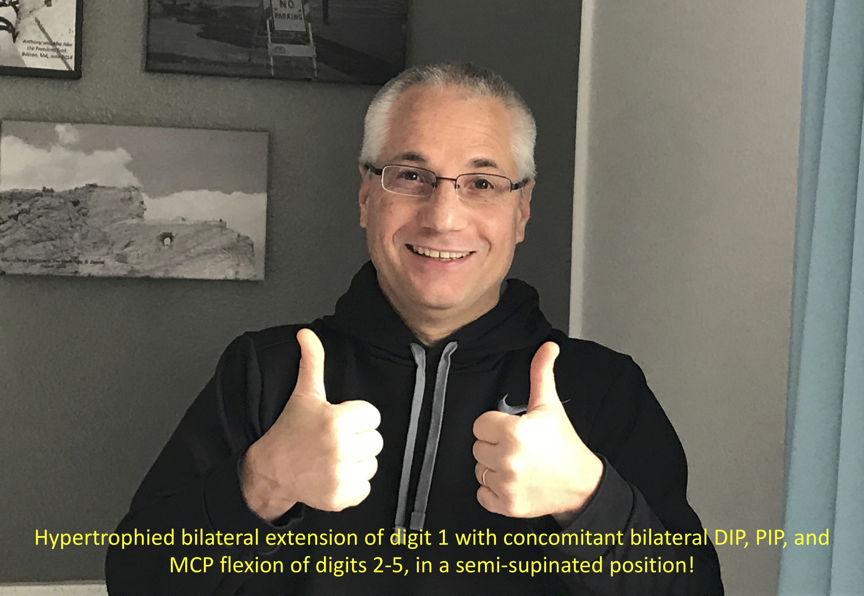 Photo of a man gesturing with two thumbs up, with text describing in anatomical terms the gesture.