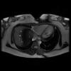 3T Cardiac Images - Axial FIESTA non gated Human Chest TE = 1.2 TR = 3.2
