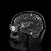 3T Neuro Images - Sagittal T2 CUBE Human Head TE = 80.5 TR = 3200.0