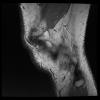 3T Ortho Images - Sagittal Human Knee TE = 34.1 TR = 3796.0