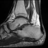 3T Ortho Images - Sagittal T1 Human Ankle TE = 10.4 TR = 481.0