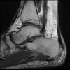 3T Ortho Images - Sagittal T1 Human Ankle TE = 10.4 TR = 481.0