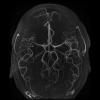 7T Neuro Image - 3D TOF 3 SLAB MT FS FA 25 Human Head TE = 2.4 TR = 21.0