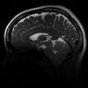7T Neuro Images - Sagittal T2 CUBE Human Head TE = 77.7 TR = 2500.0