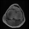 7T Ortho Images - SC-Axial T1 ARC Human Knee TE = 11.2 TR = 1125.0