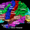 The lateral (top) surface of the human cerebral cortex parcellated into 24 sub-regions.
