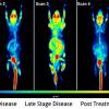 Longitudinal study in the same mouse using 18F-FDG PET imaging to monitor disease progression and response to therapy.