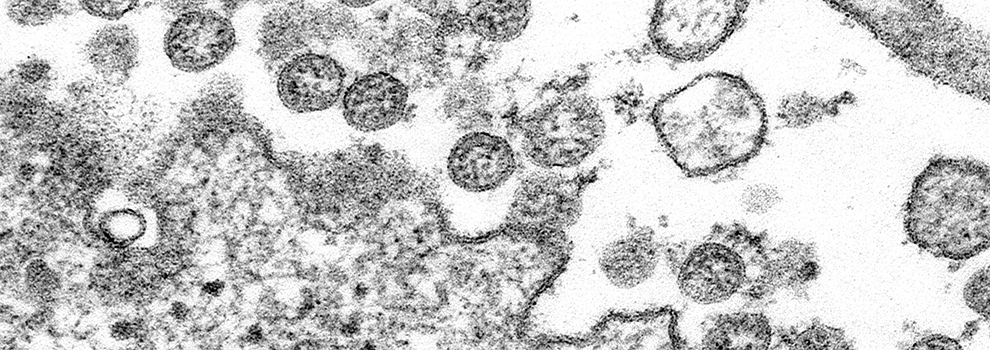Coronavirus isolate image