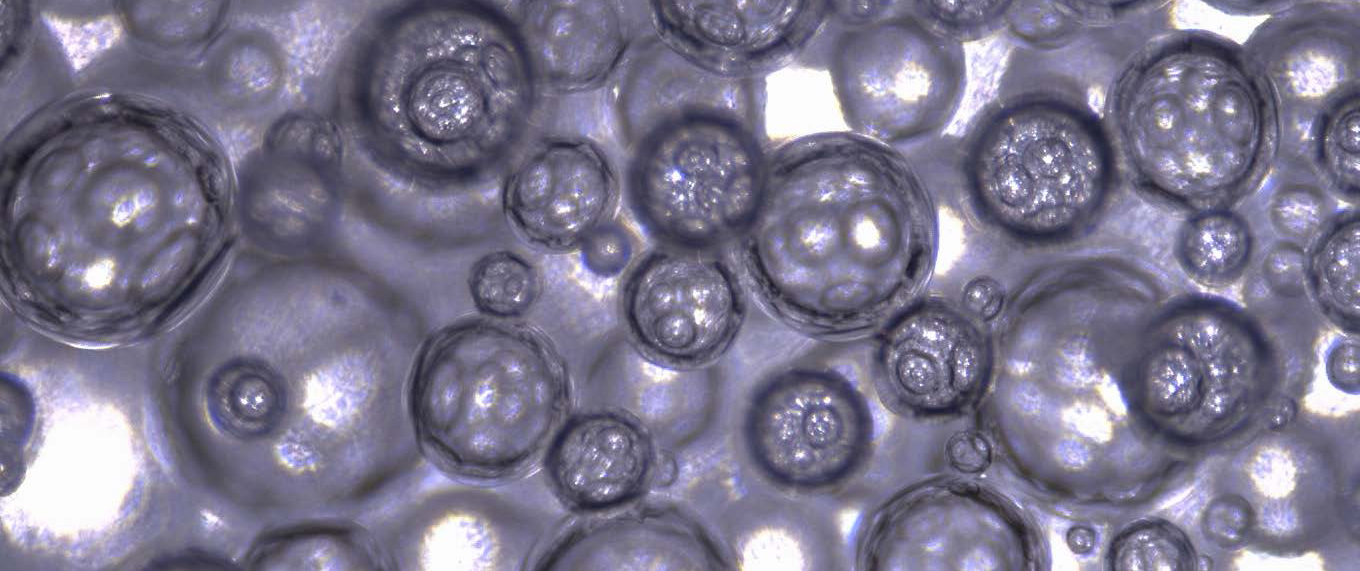Light microscopy image of the foam.