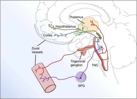 Medical illustration shows source of CGRP