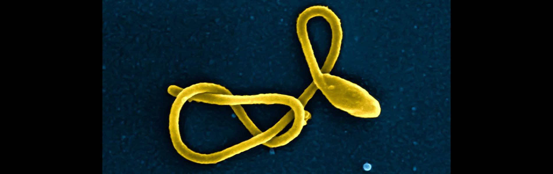 Microscope image of Ebola virus