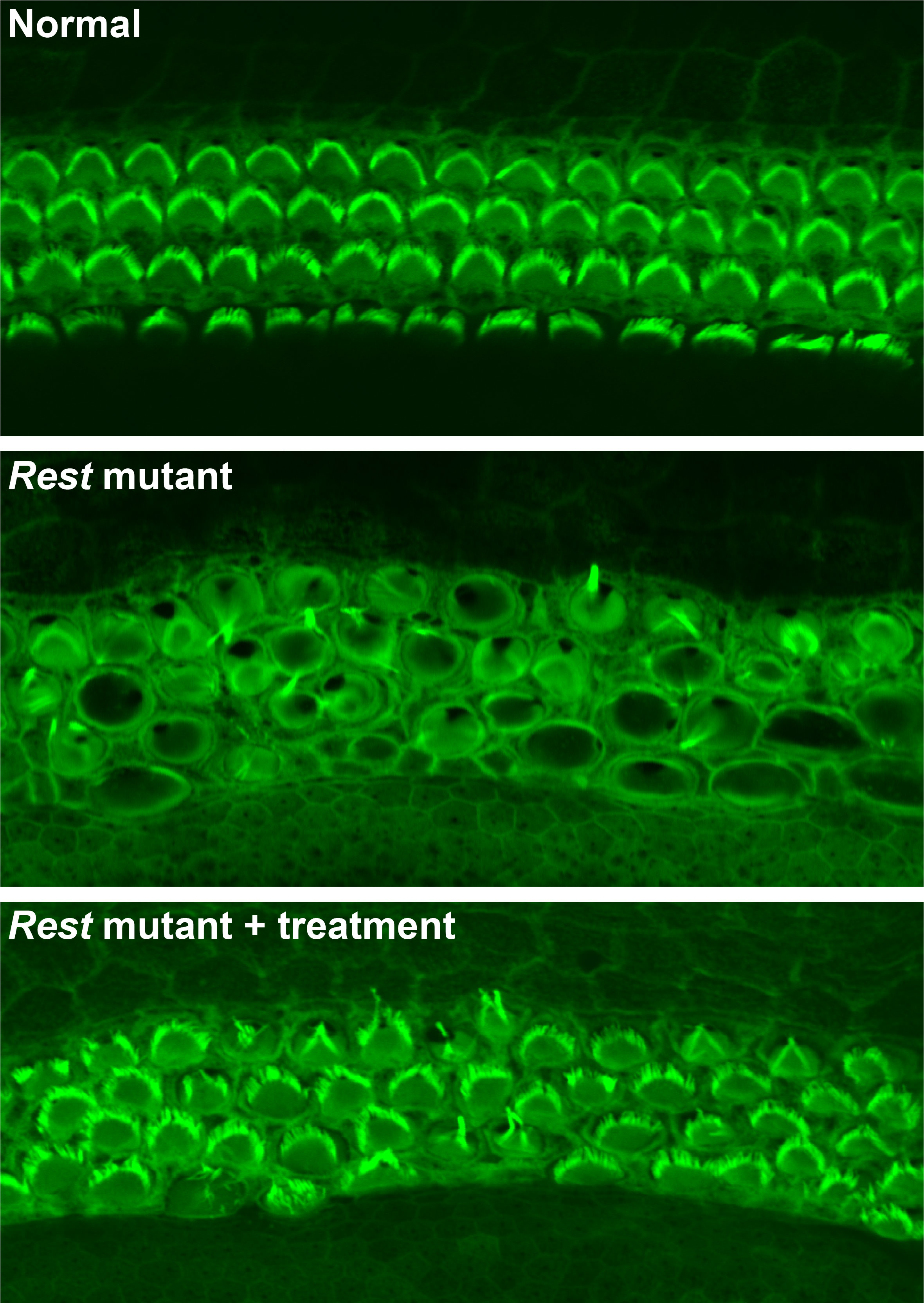 Top: Healthy hair cells depicted by rows of green arcs. Middle: Jumbled cells with no visible green arcs. Bottom: Rest mutant plus treatment—green arcs visible, but less organized than in non-mutated.