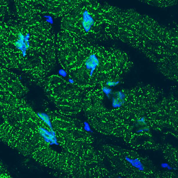 microscopic illustration of protein particles