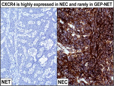 CXCR4 is highly expressed in NEC and rarely in GEP-NET