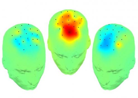 Illustration showing mapping of DBS technique
