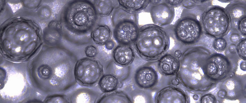 Foam GEMs - light microscopy.jpg