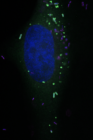 Intracellular Listeria monocytogenes bacteria (in red) are trapped by the cytosolic innate immunity protein RNF213 (in green) and nucleic acids of the host cell and bacteria are depicted in blue.