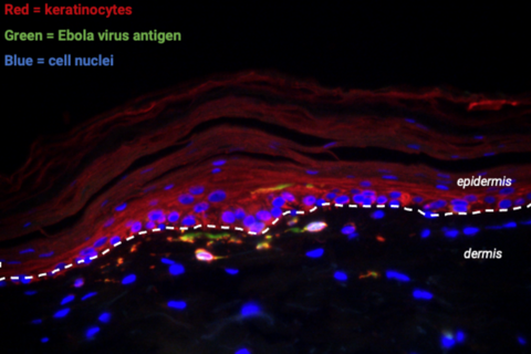 Confocal micrograph of a human skin explant infected with Ebola virus (green). UI researchers have traced the Ebola’s cellular route from inside the body to the surface of the skin, a mechanism which may explain person-to-person transmission via skin cont