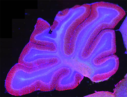 cerebellum-web.jpg
