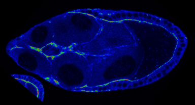 Fascin myosin activity
