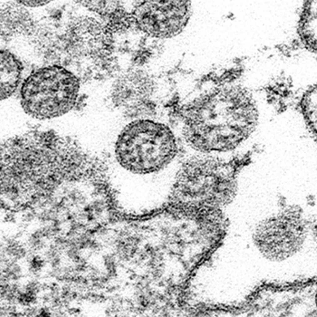 Coronavirus isolate image