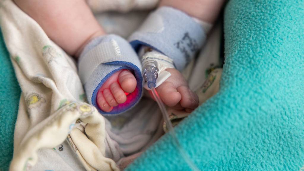 Close-up of a baby's feet wearing a heart monitor.